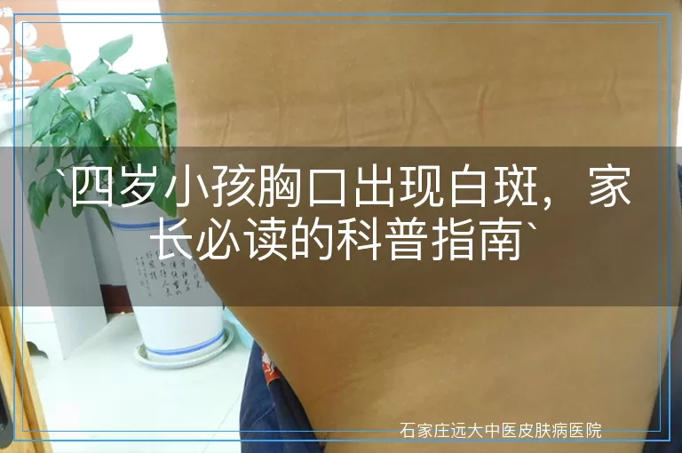 四岁小孩胸口出现白斑，家长必读的科普指南