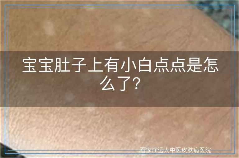 宝宝肚子上有小白点点是怎么了？