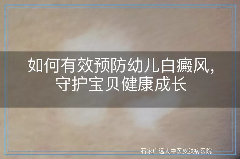 如何有效预防幼儿白癜风，守护宝贝健康成长