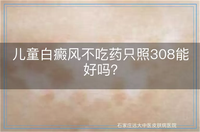 儿童白癜风不吃药只照308能好吗？