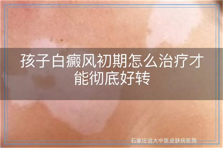 孩子白癜风初期怎么治疗才能彻底好转