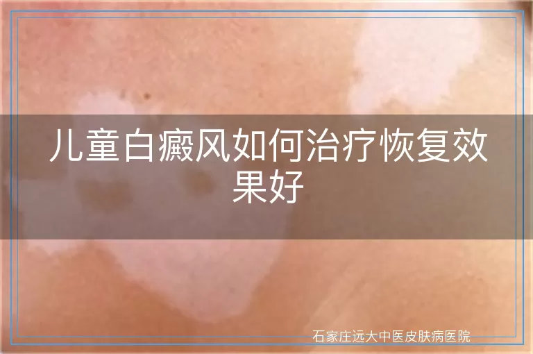 儿童白癜风如何治疗恢复效果好