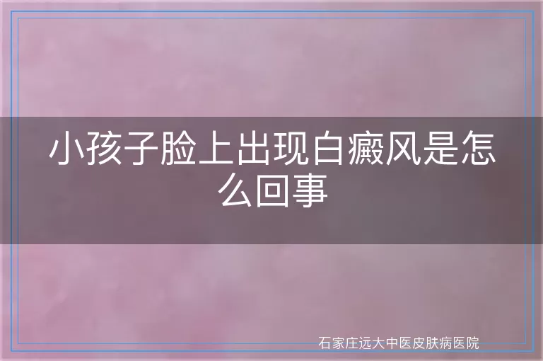 小孩子脸上出现白癜风是怎么回事