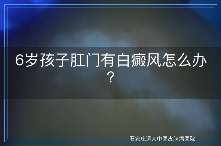 6岁孩子肛门有白癜风怎么办？