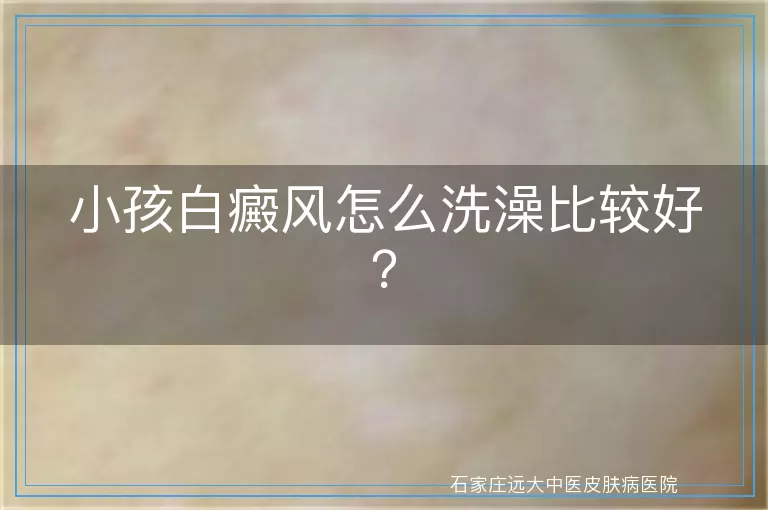 小孩白癜风怎么洗澡比较好？