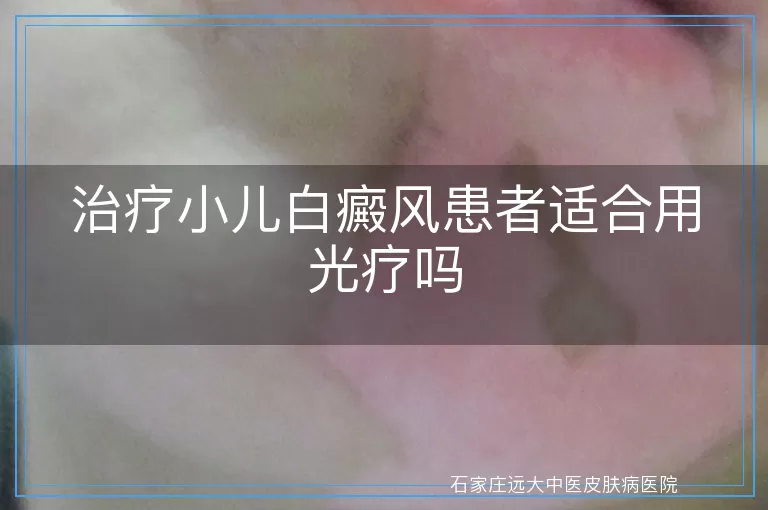 治疗小儿白癜风患者适合用光疗吗