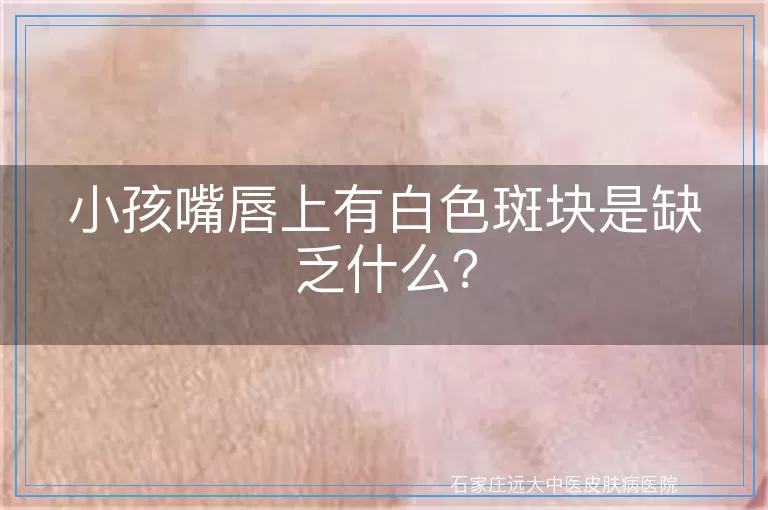 小孩嘴唇上有白色斑块是缺乏什么？