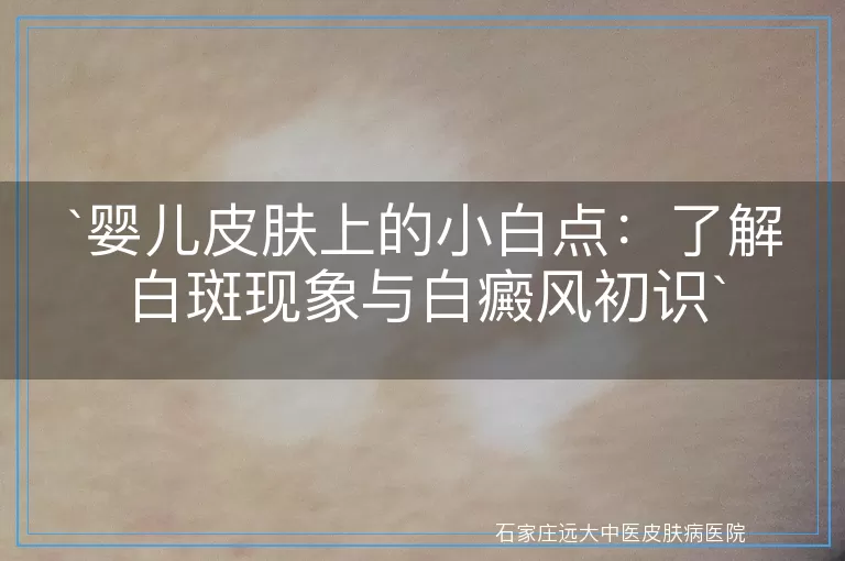 婴儿皮肤上的小白点：了解白斑现象与白癜风初识