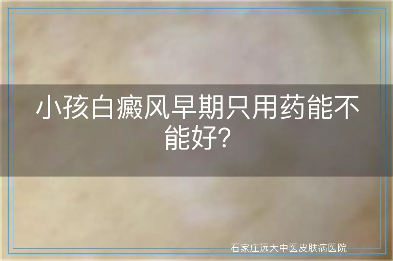 小孩白癜风早期只用药能不能好？