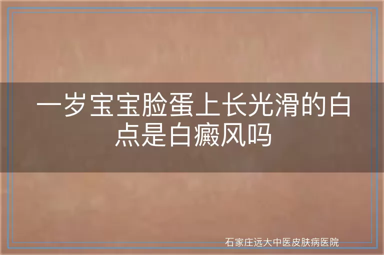 一岁宝宝脸蛋上长光滑的白点是白癜风吗