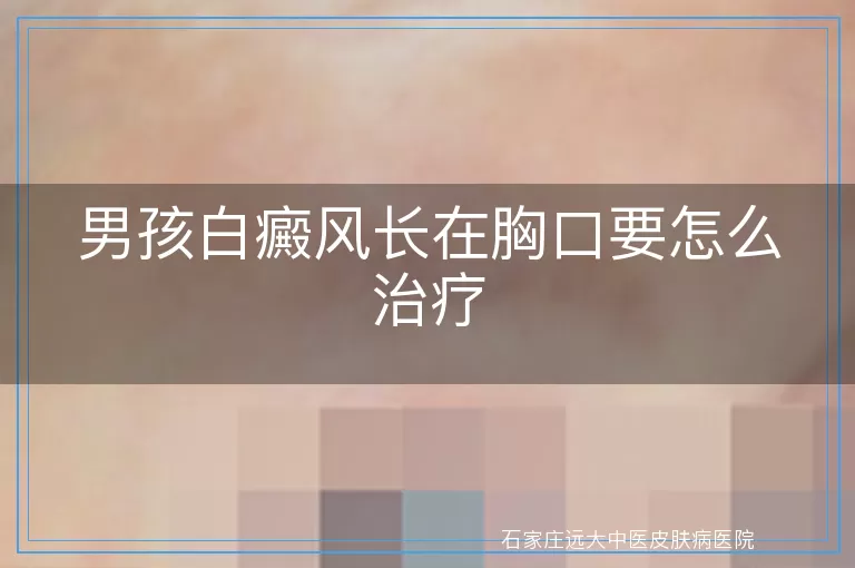 男孩白癜风长在胸口要怎么治疗