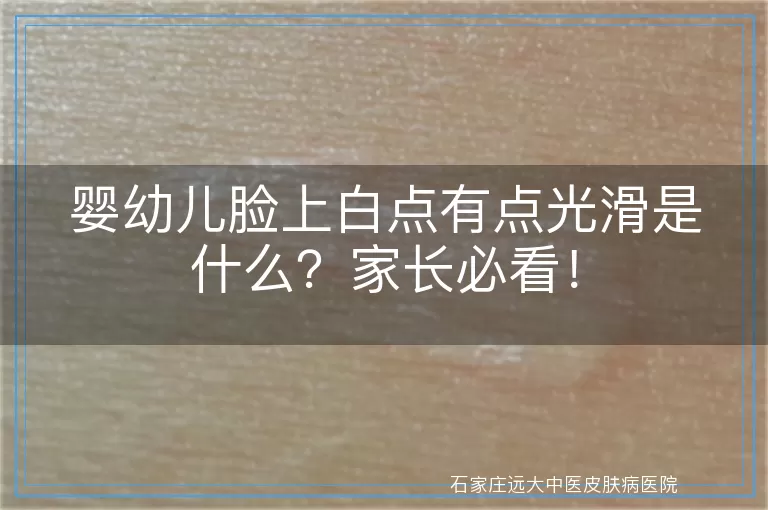 婴幼儿脸上白点有点光滑是什么？家长必看！