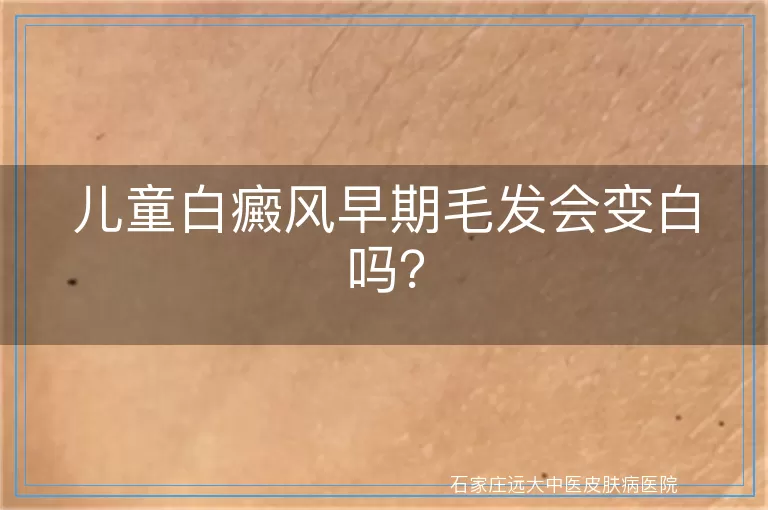 儿童白癜风早期毛发会变白吗？