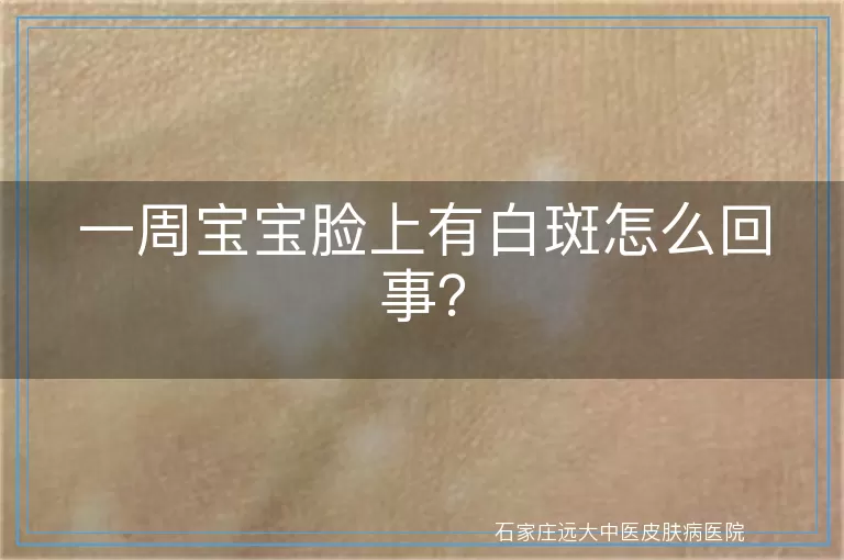 一周宝宝脸上有白斑怎么回事？