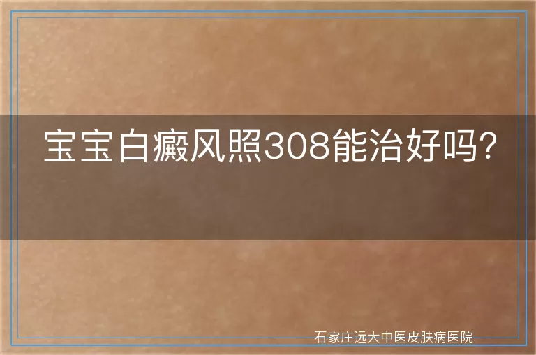 宝宝白癜风照308能治好吗？