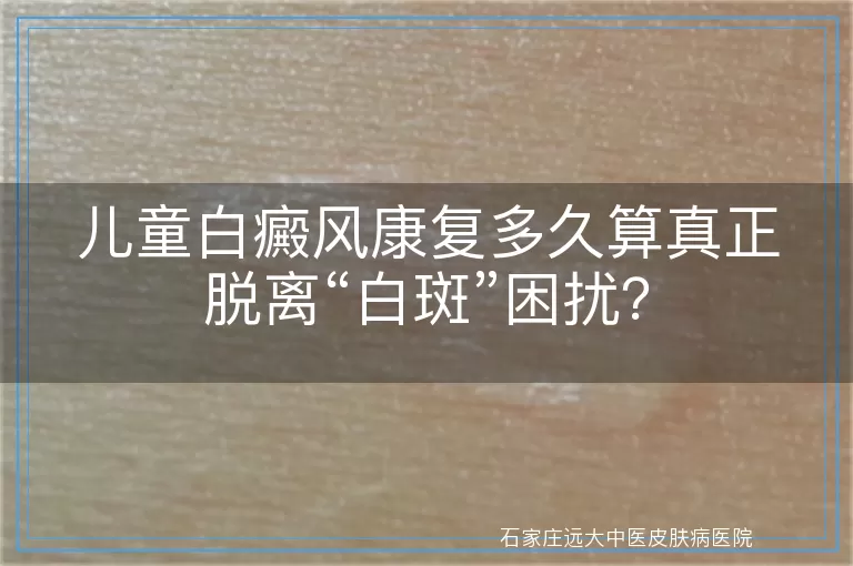 儿童白癜风康复多久算真正脱离“白斑”困扰？