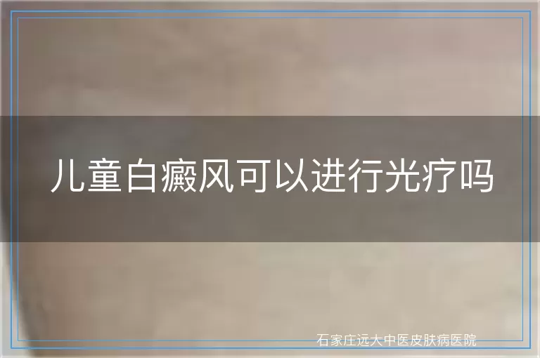 儿童白癜风可以进行光疗吗