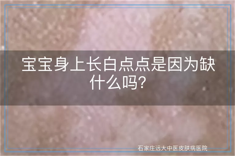 宝宝身上长白点点是因为缺什么吗？