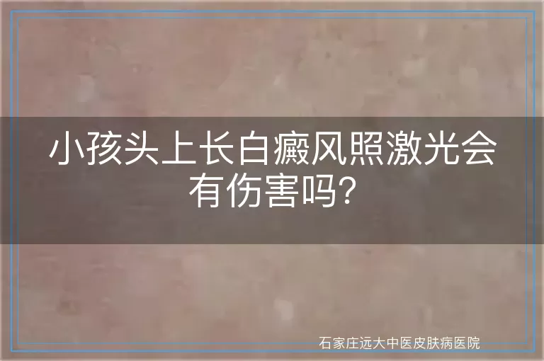 小孩头上长白癜风照激光会有伤害吗？