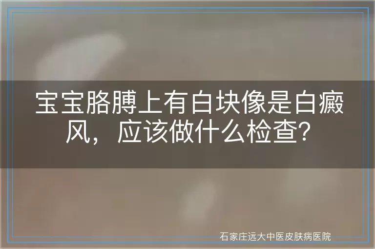 宝宝胳膊上有白块像是白癜风，应该做什么检查？