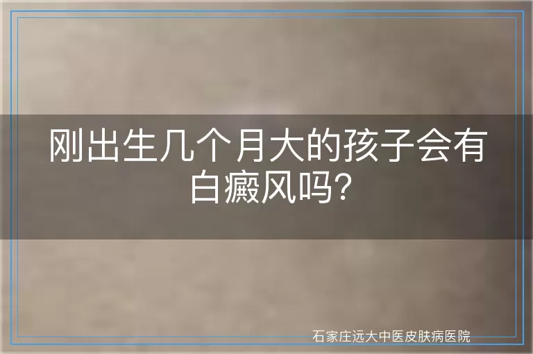 刚出生几个月大的孩子会有白癜风吗？