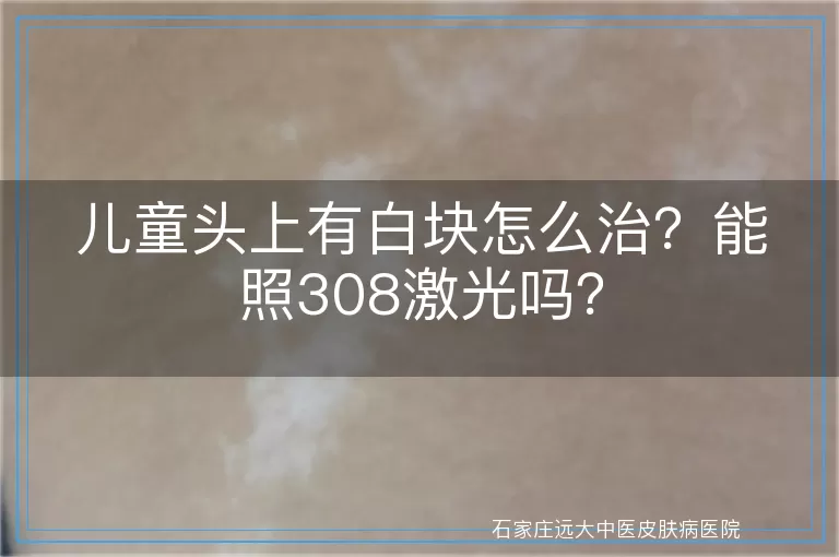 儿童头上有白块怎么治？能照308激光吗？