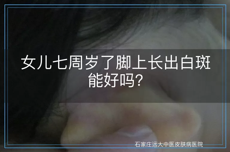 女儿七周岁了脚上长出白斑能好吗？