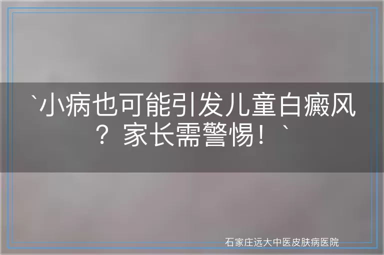 小病也可能引发儿童白癜风？家长需警惕！