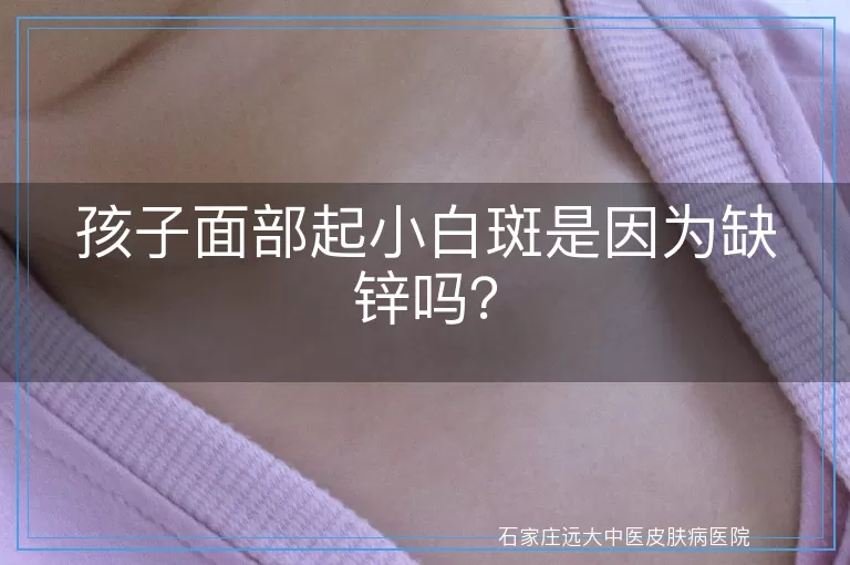 孩子面部起小白斑是因为缺锌吗？