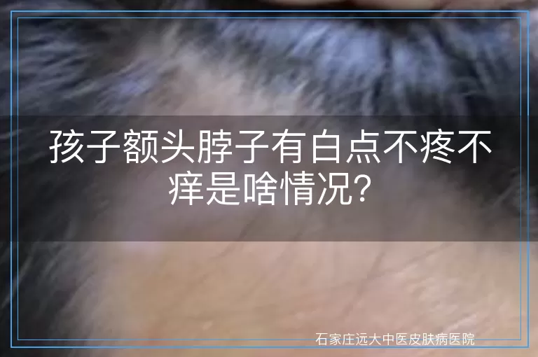 孩子额头脖子有白点不疼不痒是啥情况？