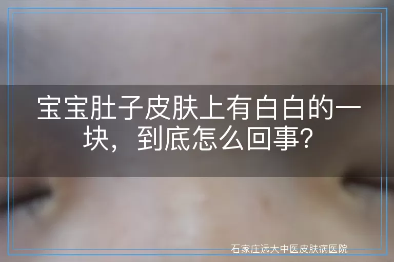 宝宝肚子皮肤上有白白的一块，到底怎么回事？