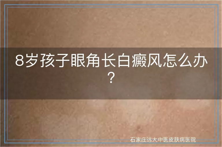 8岁孩子眼角长白癜风怎么办？