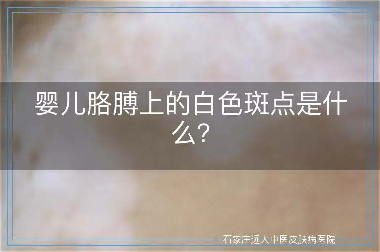 婴儿胳膊上的白色斑点是什么？