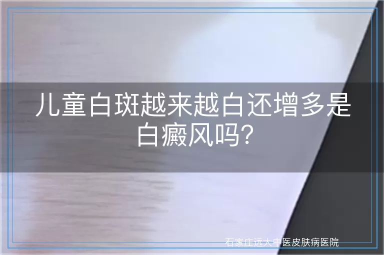 儿童白斑越来越白还增多是白癜风吗？