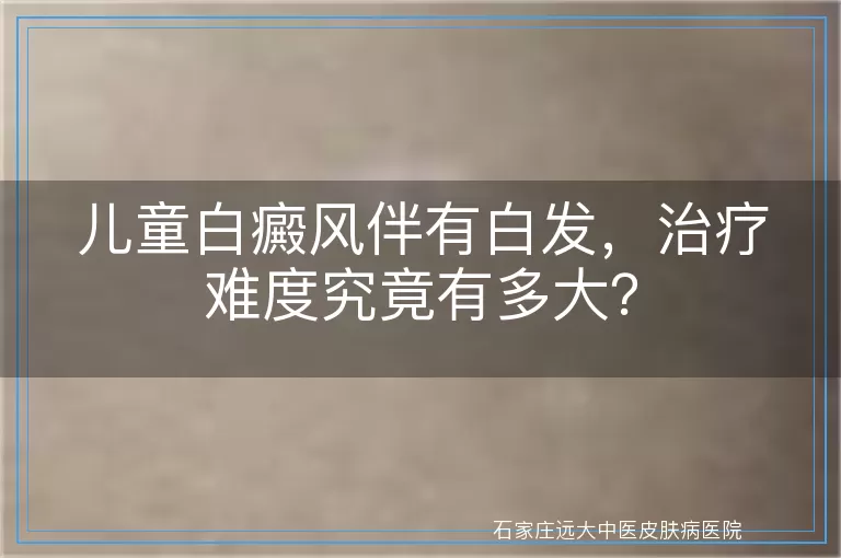 儿童白癜风伴有白发，治疗难度究竟有多大？