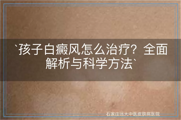 孩子白癜风怎么治疗？全面解析与科学方法