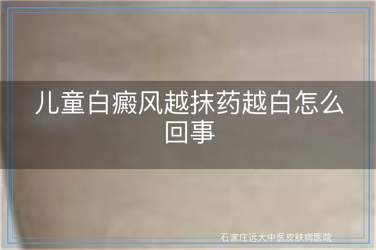 儿童白癜风越抹药越白怎么回事