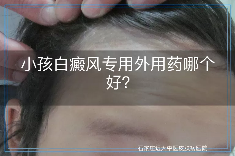 小孩白癜风专用外用药哪个好？