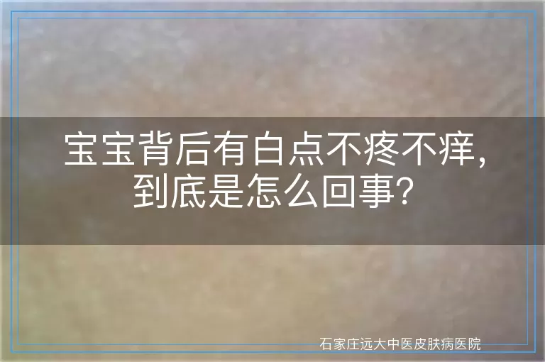 宝宝背后有白点不疼不痒，到底是怎么回事？