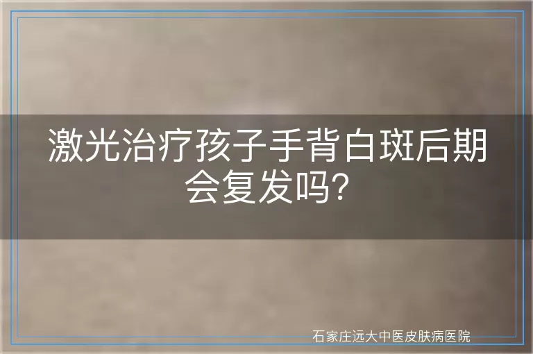 激光治疗孩子手背白斑后期会复发吗？