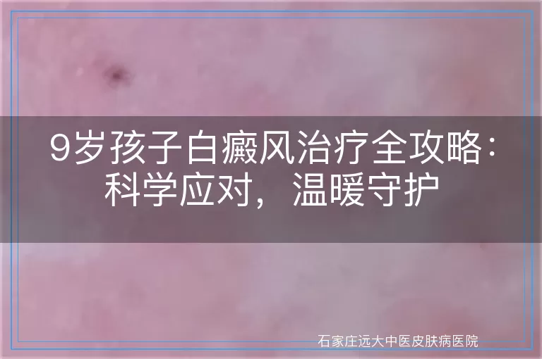 9岁孩子白癜风治疗全攻略：科学应对，温暖守护