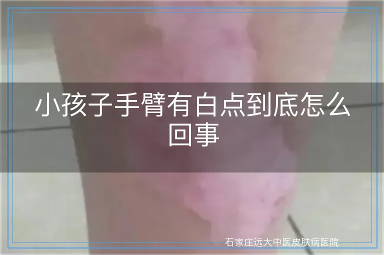 小孩子手臂有白点到底怎么回事