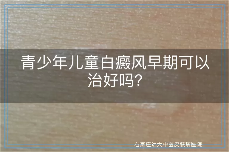 青少年儿童白癜风早期可以治好吗？