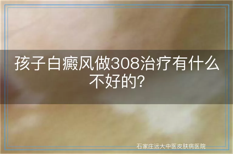 孩子白癜风做308治疗有什么不好的？