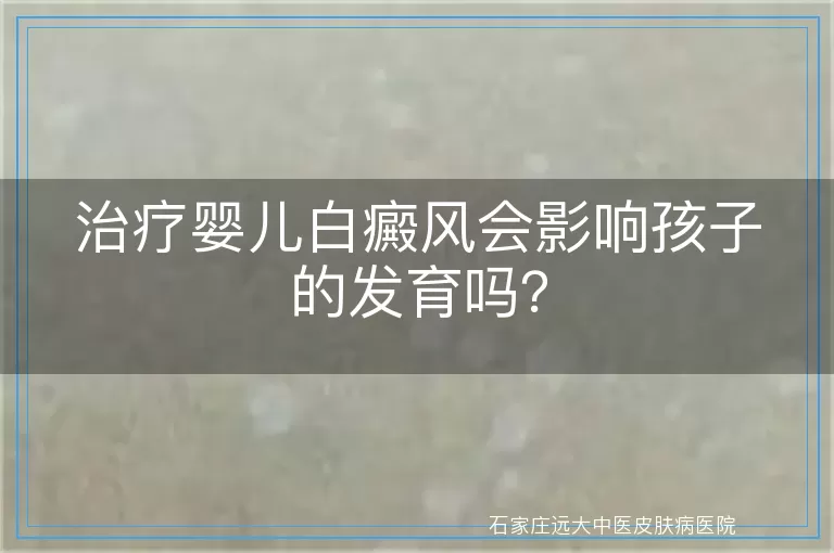 治疗婴儿白癜风会影响孩子的发育吗？