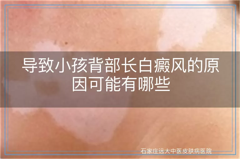 导致小孩背部长白癜风的原因可能有哪些