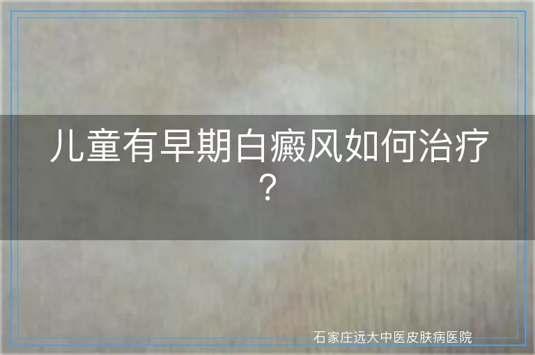 儿童有早期白癜风如何治疗？