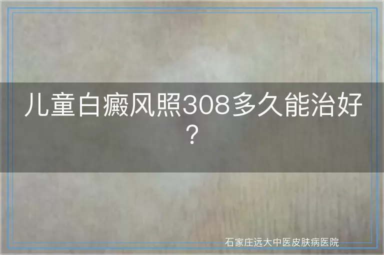 儿童白癜风照308多久能治好？