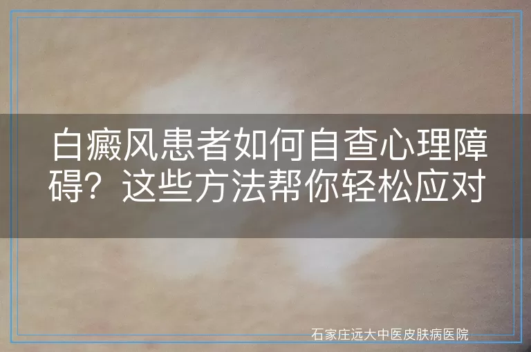 白癜风患者如何自查心理障碍？这些方法帮你轻松应对！