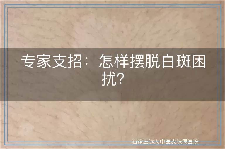 专家支招：怎样摆脱白斑困扰？